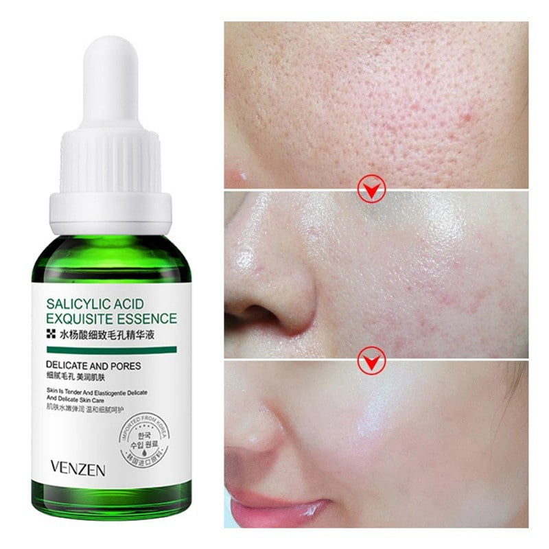 Serum Facial Acido Salicilico venzen